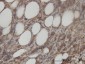 ACY1 Antibody (monoclonal) (M01)
